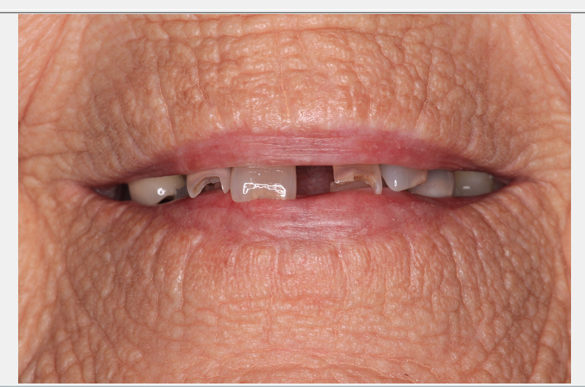 Center for Family and Implant Dentistry Center for Family and Implant Dentistry