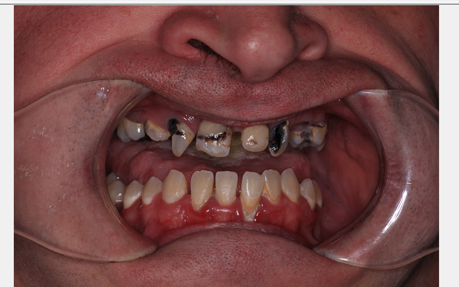 Center for Family and Implant Dentistry Center for Family and Implant Dentistry